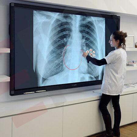 ecran-interactif-sante